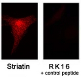 STRN / Striatin Antibody - Striatin Antibody - Immunofluorescent staining of NIH3T3 cells blocking peptide.