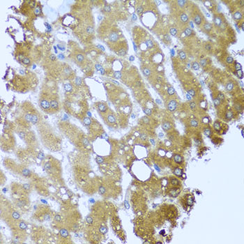 STRN / Striatin Antibody - Immunohistochemistry of paraffin-embedded human liver injury tissue.