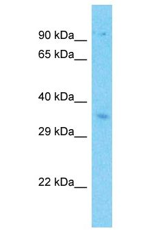 STRN3 Antibody - STRN3 antibody Western Blot of ACHN. Antibody dilution: 1 ug/ml.  This image was taken for the unconjugated form of this product. Other forms have not been tested.