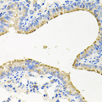 STRN3 Antibody - Immunohistochemistry of paraffin-embedded mouse lung tissue.