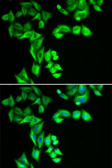 STRN3 Antibody - Immunofluorescence analysis of HeLa cells.