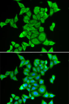 STRN3 Antibody - Immunofluorescence analysis of MCF7 cells using STRN3 antibody. Blue: DAPI for nuclear staining.