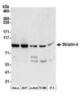 STRN4 Antibody - Detection of human and mouse Striatin-4 by western blot. Samples: Whole cell lysate (50 µg) from HeLa, HEK293T, Jurkat, mouse TCMK-1, and mouse NIH 3T3 cells prepared using NETN lysis buffer. Antibodies: Affinity purified rabbit anti-Striatin-4 antibody used for WB at 0.1 µg/ml. Detection: Chemiluminescence with an exposure time of 3 minutes.