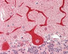 STS / ASC / Steroid Sulfatase Antibody - Human Brain, Cerebellum: Formalin-Fixed, Paraffin-Embedded (FFPE).  This image was taken for the unconjugated form of this product. Other forms have not been tested.