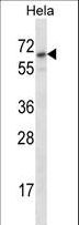 STS / ASC / Steroid Sulfatase Antibody - STS Antibody western blot of HeLa cell line lysates (35 ug/lane). The STS antibody detected the STS protein (arrow).