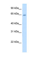 STS / ASC / Steroid Sulfatase Antibody - STS antibody ARP41710_T100-NP_000342-STS(steroid sulfatase (microsomal), arylsulfatase C, isozyme S) Antibody Western blot of Placenta lysate.  This image was taken for the unconjugated form of this product. Other forms have not been tested.