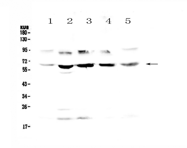 STS / ASC / Steroid Sulfatase Antibody - Western blot - Anti-Steroid sulfatase Picoband antibody