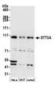 STT3A / ITM1 Antibody - Detection of human STT3A by western blot. Samples: Whole cell lysate (10 µg) from HeLa, HEK293T, and Jurkat cells prepared using NETN lysis buffer. Antibody: Affinity purified rabbit anti-STT3A antibody used for WB at 0.1 µg/ml. Detection: Chemiluminescence with an exposure time of 30 seconds.