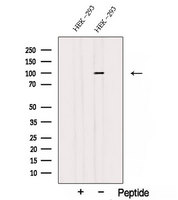 STT3A / ITM1 Antibody - Western blot analysis of extracts of HEK293 cells using STT3A antibody. The lane on the left was treated with blocking peptide.