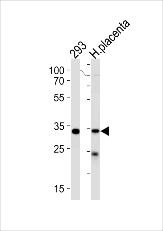 STUB1 / CHIP Antibody - CHIP Antibody western blot of 293 cell line and human placenta lysates (35 ug/lane). The CHIP antibody detected the CHIP protein (arrow).