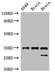 STUB1 / CHIP Antibody - Positive WB detected in:A549 whole cell lysate,Rat brain tissue,Mouse brain tissue;All lanes:STUB1 antibody at 2?g/ml;Secondary;Goat polyclonal to rabbit IgG at 1/50000 dilution;Predicted band size: 35,28 KDa;Observed band size: 35,28 KDa;