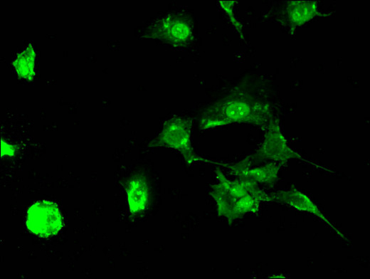STUB1 / CHIP Antibody - Immunofluorescent analysis of MCF-7 cells using STUB1 Antibody at a dilution of 1:100 and Alexa Fluor 488-congugated AffiniPure Goat Anti-Rabbit IgG(H+L)