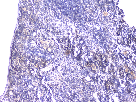 STUB1 / CHIP Antibody - IHC analysis of STUB1 using anti-STUB1 antibody. STUB1 was detected in paraffin-embedded section of mouse spleen tissues. Heat mediated antigen retrieval was performed in citrate buffer (pH6, epitope retrieval solution) for 20 mins. The tissue section was blocked with 10% goat serum. The tissue section was then incubated with 1µg/ml rabbit anti-STUB1 Antibody overnight at 4°C. Biotinylated goat anti-rabbit IgG was used as secondary antibody and incubated for 30 minutes at 37°C. The tissue section was developed using Strepavidin-Biotin-Complex (SABC) with DAB as the chromogen.
