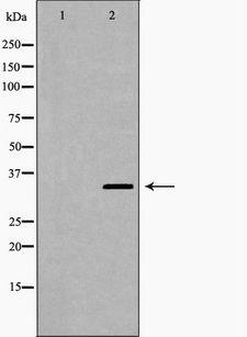 STUB1 / CHIP Antibody - Western blot analysis of mouse brain lysate using STUB1 antibody. The lane on the left is treated with the antigen-specific peptide.