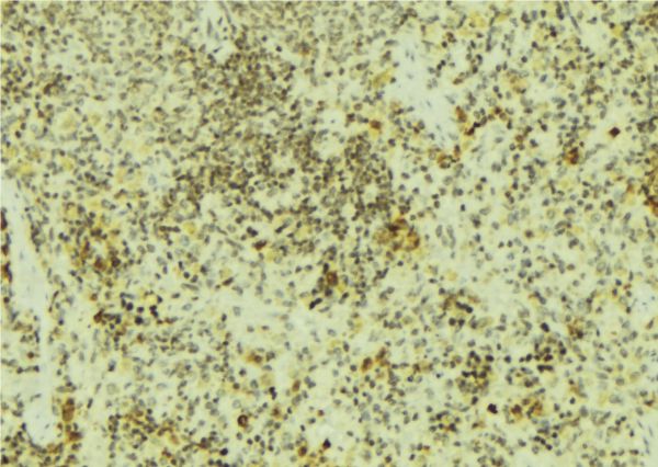 STUB1 / CHIP Antibody - 1:100 staining mouse pancreas tissue by IHC-P. The sample was formaldehyde fixed and a heat mediated antigen retrieval step in citrate buffer was performed. The sample was then blocked and incubated with the antibody for 1.5 hours at 22°C. An HRP conjugated goat anti-rabbit antibody was used as the secondary.