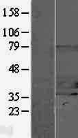 STUB1 / CHIP Protein - Western validation with an anti-DDK antibody * L: Control HEK293 lysate R: Over-expression lysate