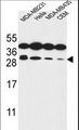 STX10 / Syntaxin 10 Antibody - STX10 Antibody western blot of MDA-MB231,HeLa,MDA-MB435,CEM cell line lysates (35 ug/lane). The STX10 antibody detected the STX10 protein (arrow).