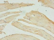 STX10 / Syntaxin 10 Antibody - Immunohistochemistry of paraffin-embedded human Skeletal muscle tissue using antibody at dilution of 1:100.