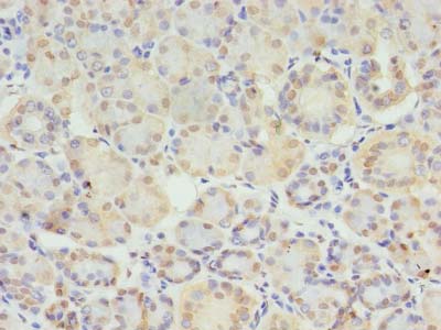 STX10 / Syntaxin 10 Antibody - Immunohistochemistry of paraffin-embedded human pancreatic tissue using antibody at dilution of 1:100.