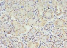 STX10 / Syntaxin 10 Antibody - Immunohistochemistry of paraffin-embedded human pancreatic tissue using antibody at 1:100 dilution.