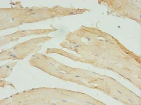 STX10 / Syntaxin 10 Antibody - Immunohistochemistry of paraffin-embedded human skeletal muscle tissue using antibody at 1:100 dilution.