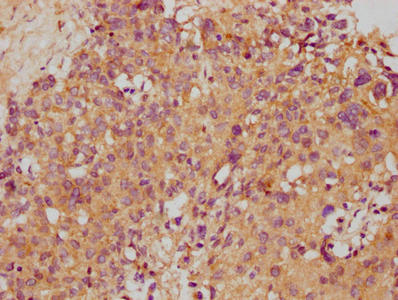 STX10 / Syntaxin 10 Antibody - Immunohistochemistry of paraffin-embedded human pancreatic tissue using STX10 Antibody at dilution of 1:100