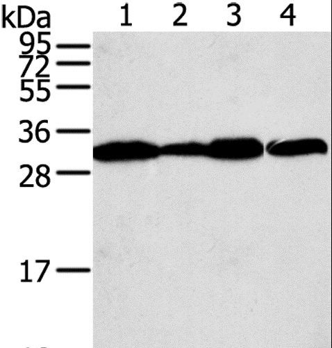 STX10 / Syntaxin 10 Antibody - Western blot analysis of A375, A431, LOVO and HeLa cell, using STX10 Polyclonal Antibody at dilution of 1:800.