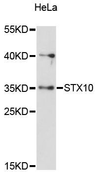 STX10 / Syntaxin 10 Antibody - Western blot analysis of extracts of HeLa cells, using STX10 antibody at 1:3000 dilution. The secondary antibody used was an HRP Goat Anti-Rabbit IgG (H+L) at 1:10000 dilution. Lysates were loaded 25ug per lane and 3% nonfat dry milk in TBST was used for blocking. An ECL Kit was used for detection and the exposure time was 90s.