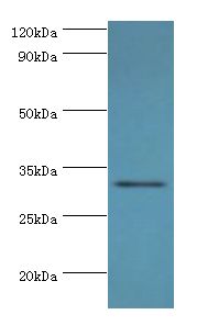 STX11 / Syntaxin 11 Antibody - Western blot. All lanes: STX11 antibody at 6 ug/ml+mouse skeletal muscle tissue. Secondary antibody: Goat polyclonal to rabbit at 1:10000 dilution. Predicted band size: 33 kDa. Observed band size: 33 kDa.