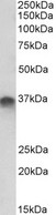 STX11 / Syntaxin 11 Antibody - STX11 antibody (1 ug/ml) staining of Placenta lysate (35 ug protein in RIPA buffer). Primary incubation was 1 hour. Detected by chemiluminescence.
