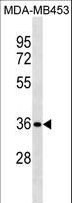STX11 / Syntaxin 11 Antibody - STX11 Antibody western blot of MDA-MB453 cell line lysates (35 ug/lane). The STX11 antibody detected the STX11 protein (arrow).