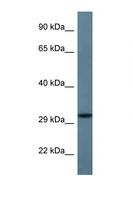 STX11 / Syntaxin 11 Antibody - STX11 antibody Western blot of Fetal Heart lysate. Antibody concentration 1 ug/ml.  This image was taken for the unconjugated form of this product. Other forms have not been tested.