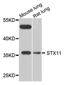 STX11 / Syntaxin 11 Antibody - Western blot analysis of extract of various cells.