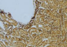 STX11 / Syntaxin 11 Antibody - 1:100 staining mouse kidney tissue by IHC-P. The sample was formaldehyde fixed and a heat mediated antigen retrieval step in citrate buffer was performed. The sample was then blocked and incubated with the antibody for 1.5 hours at 22°C. An HRP conjugated goat anti-rabbit antibody was used as the secondary.