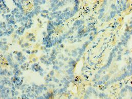 STX12 / Syntaxin 12 Antibody - Immunohistochemistry of paraffin-embedded human lung using antibody at 1:100 dilution.