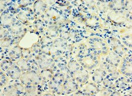 STX12 / Syntaxin 12 Antibody - Immunohistochemistry of paraffin-embedded human pancreas using antibody at 1:100 dilution.