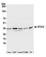 STX12 / Syntaxin 12 Antibody - Detection of human and mouse STX12 by western blot. Samples: Whole cell lysate (50 µg) from HeLa, HEK293T, Jurkat, mouse TCMK-1, and mouse NIH 3T3 cells prepared using NETN lysis buffer. Antibody: Affinity purified rabbit anti-STX12 antibody used for WB at 0.4 µg/ml. Detection: Chemiluminescence with an exposure time of 10 seconds.