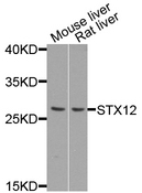 STX12 / Syntaxin 12 Antibody - Western blot analysis of extract of various cells.