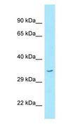 STX16 / Syntaxin 16 Antibody - STX16 / Syntaxin 16 antibody Western Blot of Fetal Kidney.  This image was taken for the unconjugated form of this product. Other forms have not been tested.