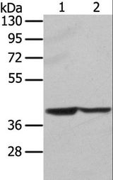 STX16 / Syntaxin 16 Antibody - Western blot analysis of HeLa and hepg2 cell, using STX16 Polyclonal Antibody at dilution of 1:400.