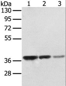 STX16 / Syntaxin 16 Antibody - Western blot analysis of MCF7, A172 and hepg2 cell, using STX16 Polyclonal Antibody at dilution of 1:400.