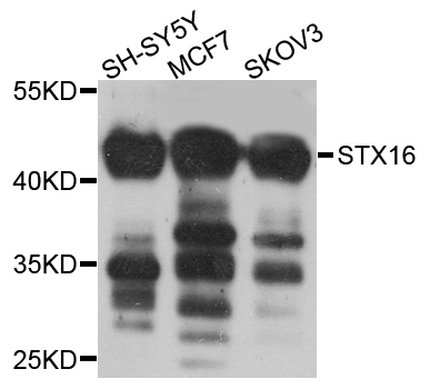 STX16 / Syntaxin 16 Antibody - Western blot analysis of extract of various cells.