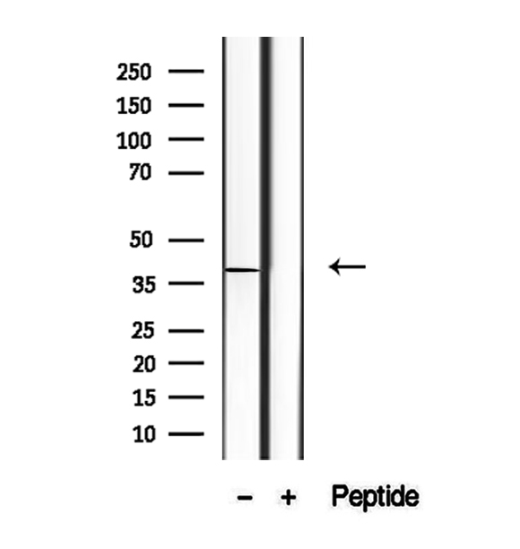 STX16 / Syntaxin 16 Antibody - Western blot analysis of extracts of Jurkat cells using Syntaxin 16 antibody.
