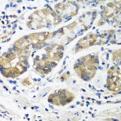 STX16 / Syntaxin 16 Antibody - Immunohistochemistry of paraffin-embedded Human stomach using STX16 Polyclonal Antibody at dilution of 1:100 (40x lens).