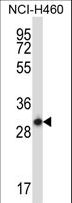 STX17 / Syntaxin 17 Antibody - STX17 Antibody western blot of NCI-H460 cell line lysates (35 ug/lane). The STX17 antibody detected the STX17 protein (arrow).