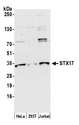 STX17 / Syntaxin 17 Antibody - Detection of human STX17 by western blot. Samples: Whole cell lysate (50 µg) from HeLa, HEK293T, and Jurkat cells prepared using NETN lysis buffer. Antibody: Affinity purified rabbit anti-STX17 antibody used for WB at 1:1000. Detection: Chemiluminescence with an exposure time of 30 seconds.