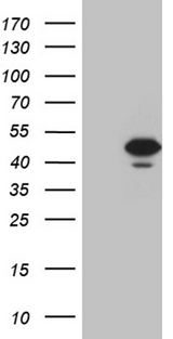 STX18 / Syntaxin 18 Antibody - HEK293T cells were transfected with the pCMV6-ENTRY control. (Left lane) or pCMV6-ENTRY STX18. (Right lane) cDNA for 48 hrs and lysed
