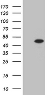 STX18 / Syntaxin 18 Antibody - HEK293T cells were transfected with the pCMV6-ENTRY control. (Left lane) or pCMV6-ENTRY STX18. (Right lane) cDNA for 48 hrs and lysed. Equivalent amounts of cell lysates. (5 ug per lane) were separated by SDS-PAGE and immunoblotted with anti-STX18. (1:2000)