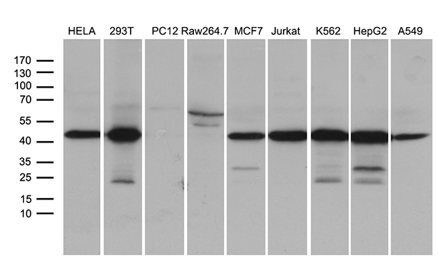 STX18 / Syntaxin 18 Antibody - Western blot analysis of extracts. (35ug) from 9 different cell lines by using anti-STX18 monoclonal antibody. (1:500)