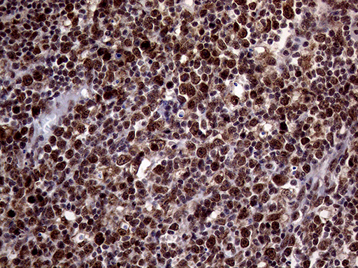 STX18 / Syntaxin 18 Antibody - Immunohistochemical staining of paraffin-embedded Human lymph node tissue within the normal limits using anti-STX18 mouse monoclonal antibody. (Heat-induced epitope retrieval by 1mM EDTA in 10mM Tris buffer. (pH8.5) at 120°C for 3 min. (1:2000)
